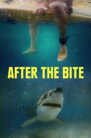 After the Bite ซับไทย